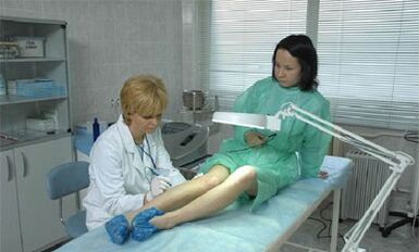 kā ārstēt varikozas vēnas uz kājām